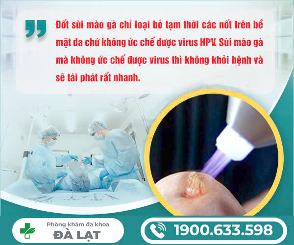 Hình ảnh minh họa